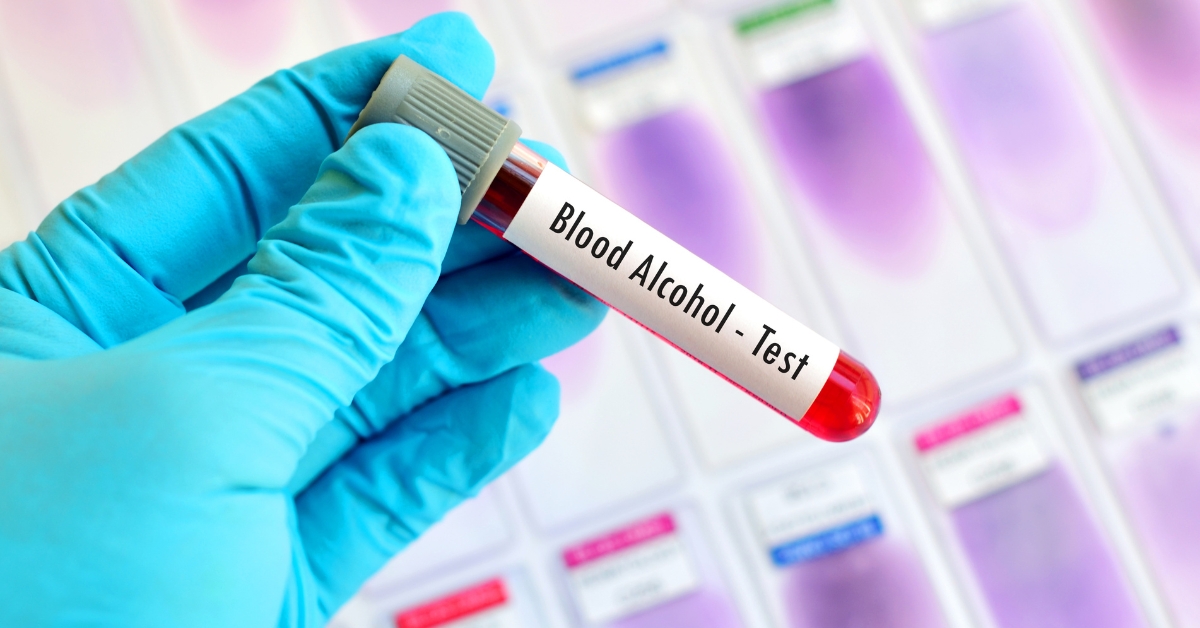blood alcohol test